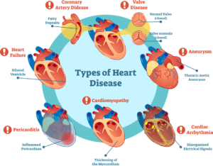 Everything You Need to Know About Heart Disease