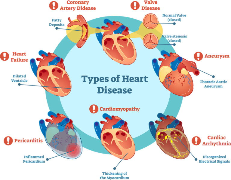 everything-you-need-to-know-about-heart-disease-mamelodi-tv